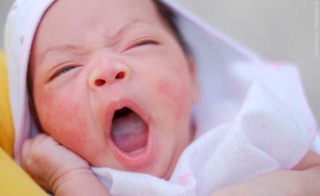 Baby und Kleinkind – rundum versorgt bei Haut- oder Erkältungsbeschwerden